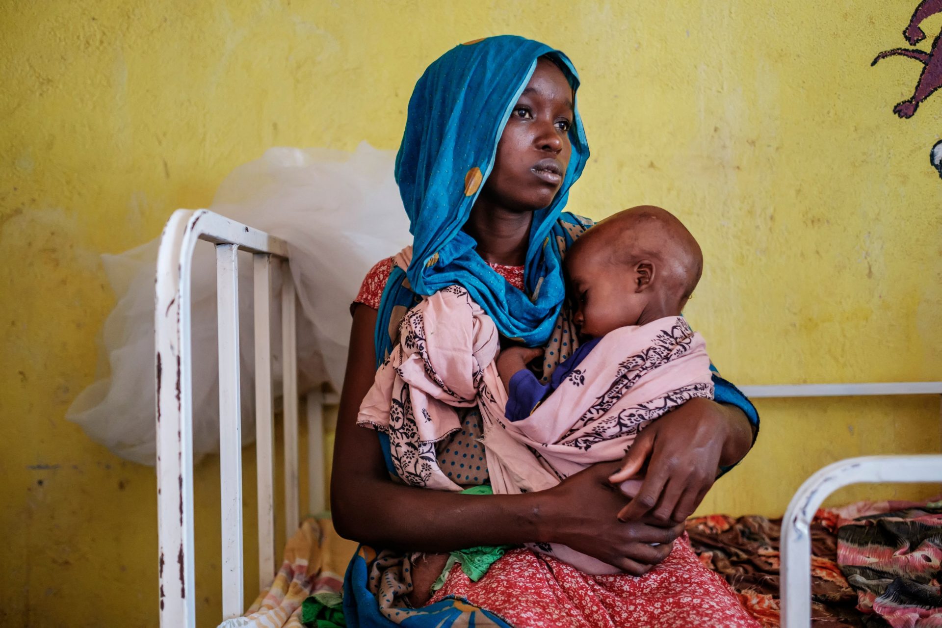 På Kelafo Health Center i Etiopien modtager man mange børn, der lider af fejl- og underernæring. Millioner af børn risikerer at dø som følge af hungersnød og tørke på Afrikas Horn. Foto: Eduardo Soteras/AFP/Ritzau Scanpix